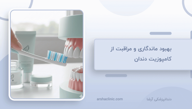 بهبود ماندگاری و مراقبت از کامپوزیت دندان