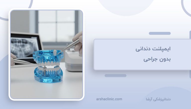 ایمپلنت دندانی بدون جراحی