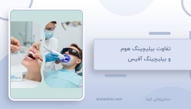 تفاوت بیلیچینگ هوم و بیلیچینگ افیس
